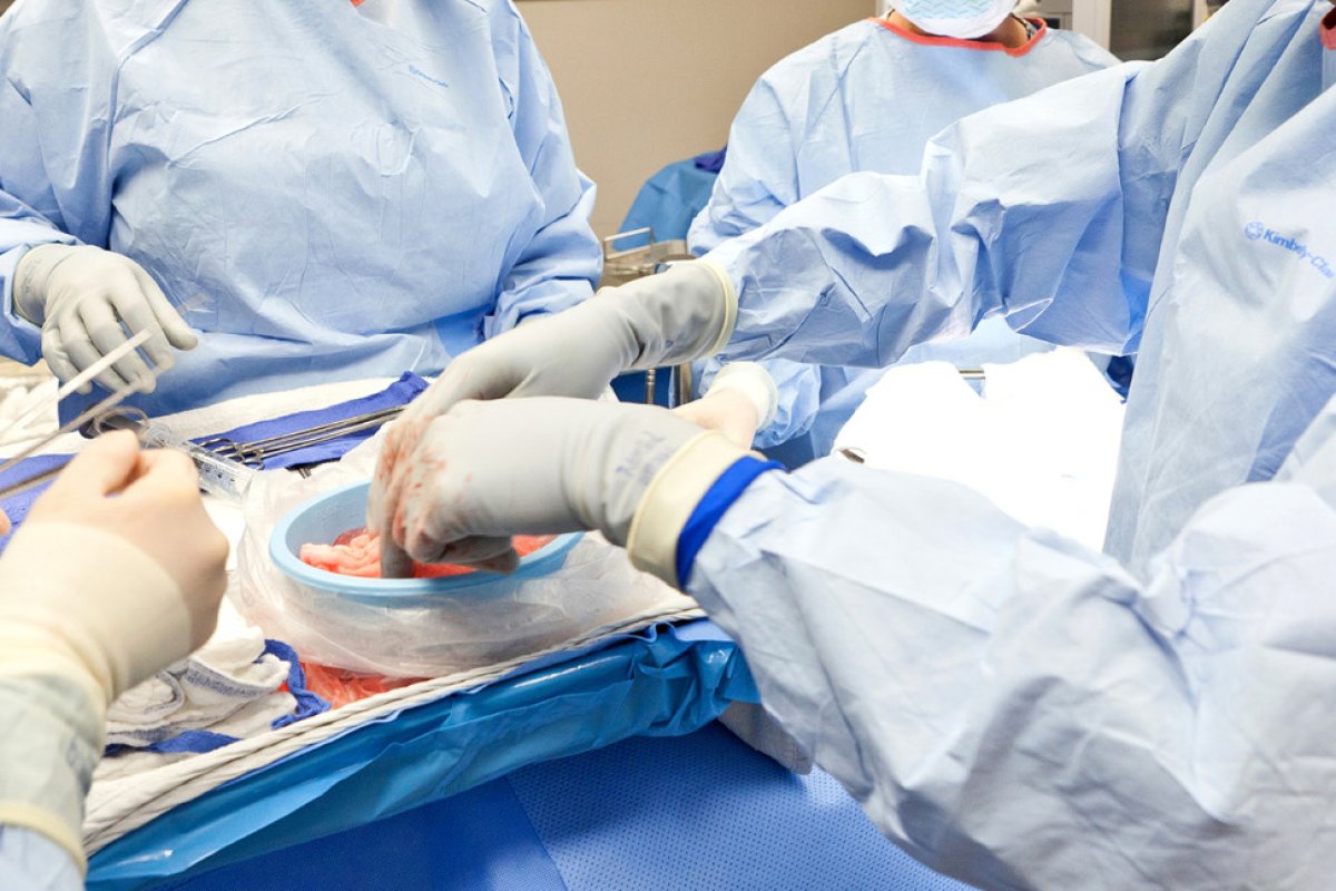 Four surgeons in blue gowns around an operating table.